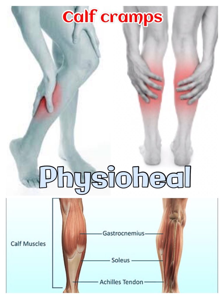 Leg Cramps At Night Anyone Physioheal 