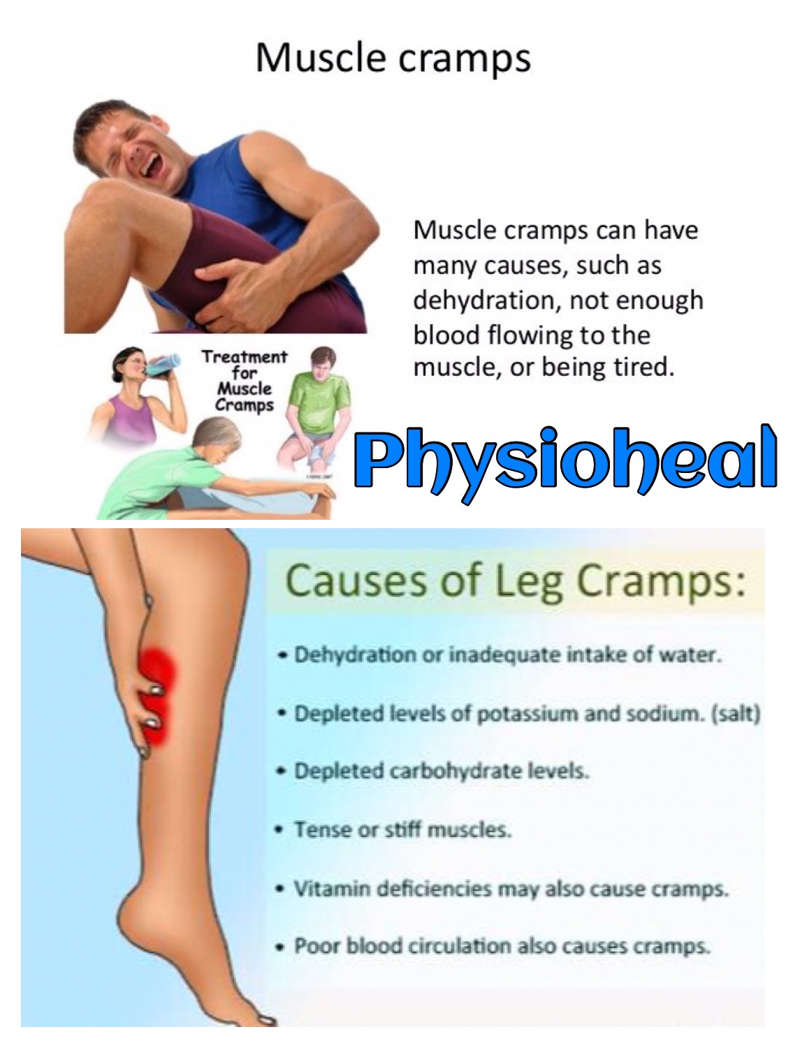 What is Leg Cramp? - PhysioHeal