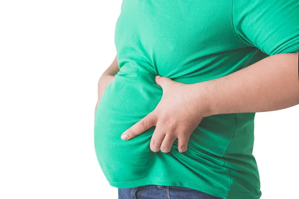 Obesity Physiotherapy