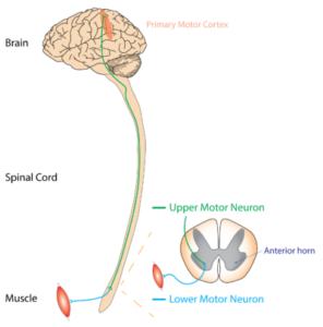 Motor Neurone Disease