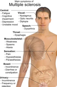 Multiple Sclerosis - Physioheal Physiotherapy