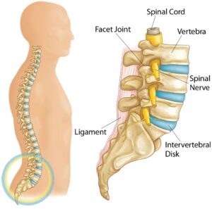 Slipped disc