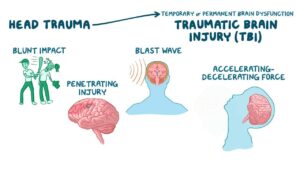 Traumatic brain injury